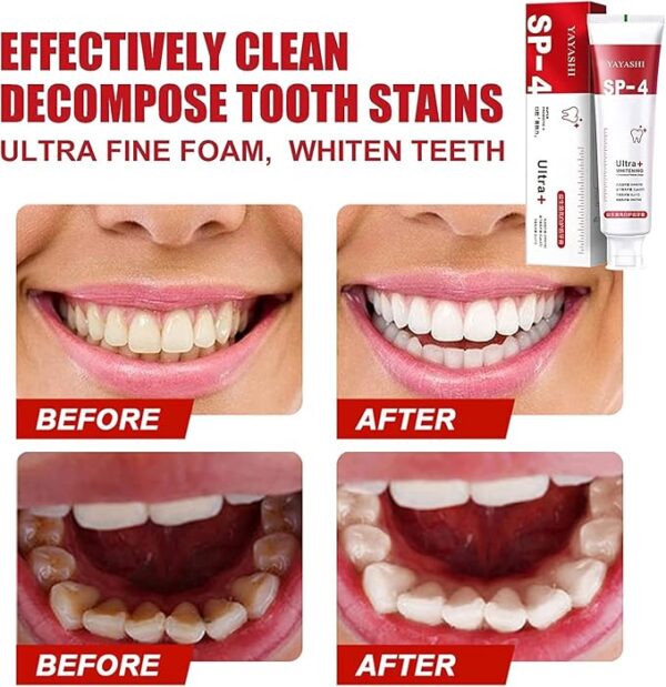 Teeth whitening toothpaste - Image 3